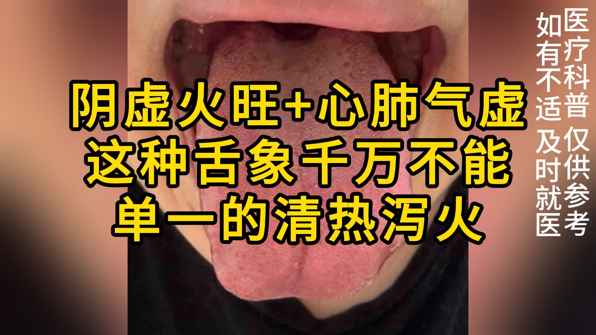 民工快餐泻火视频拍摄指南与行业现状解析