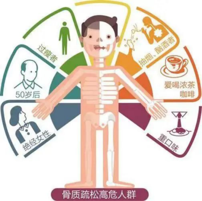 骨质疏松：“静悄悄的流行病”？...
