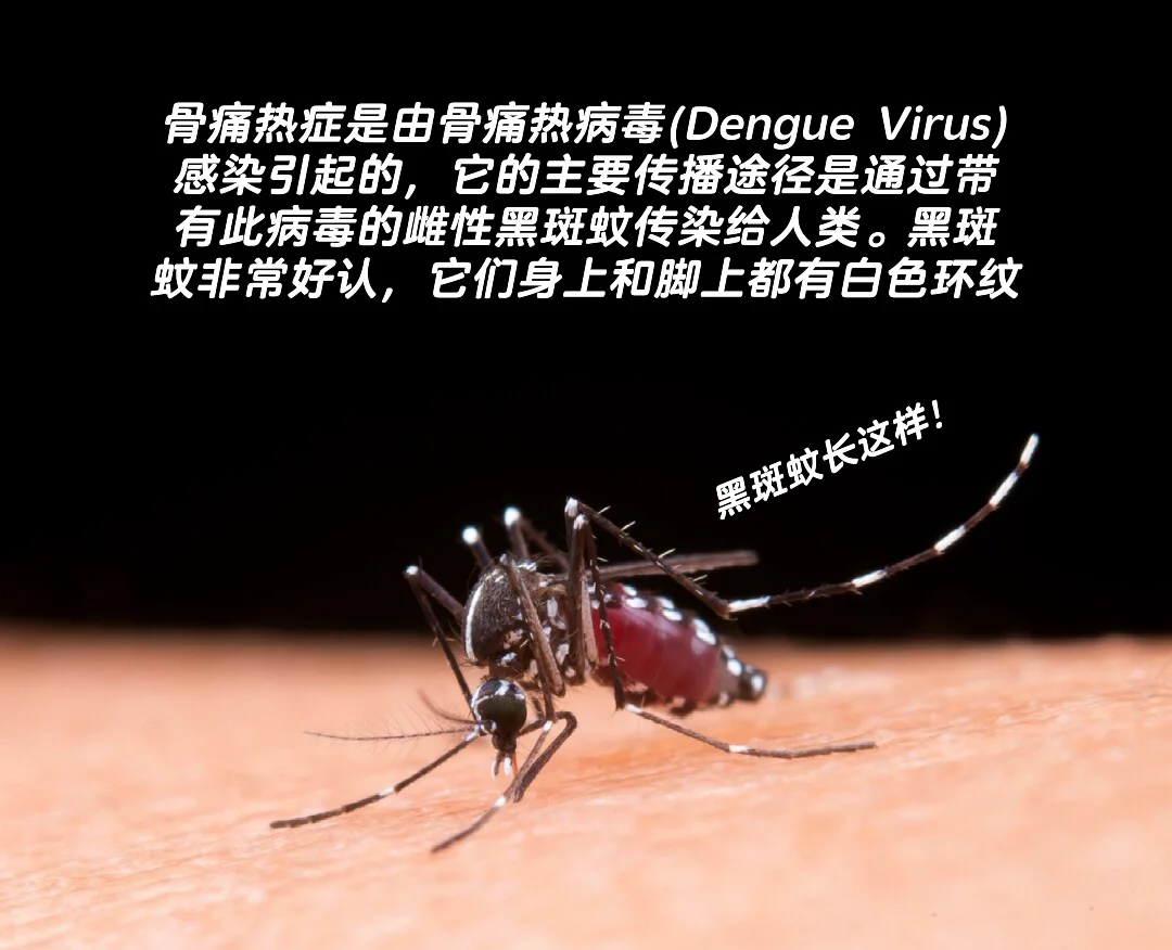 新加坡骨痛热病症状 感染登革热如何预防