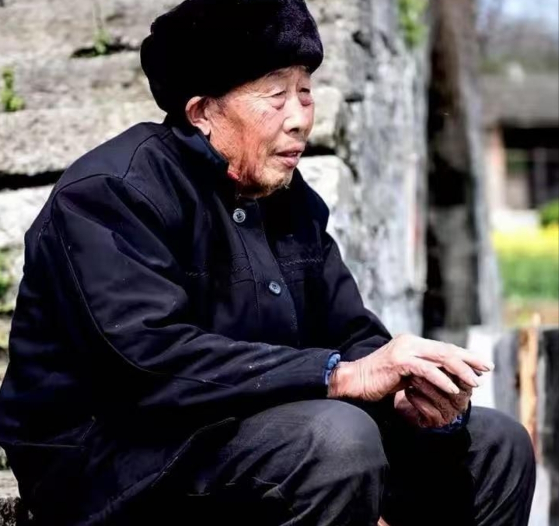 系统性红斑狼疮寿命有多长 红斑狼疮患者一般能活多久